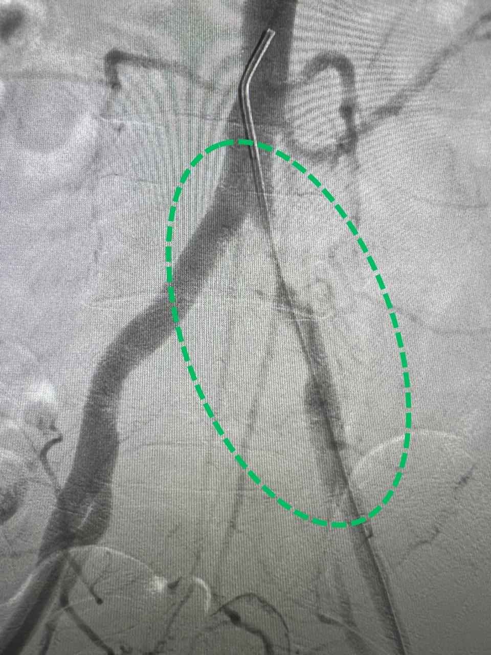 Finding the Arteries