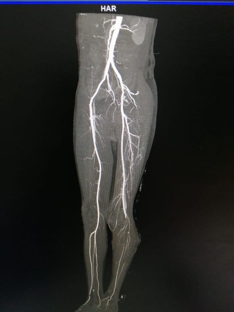 Vascular Injury