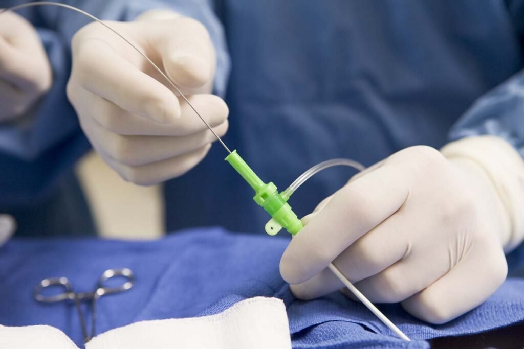 What is Endovascular Surgery,and how does it work?