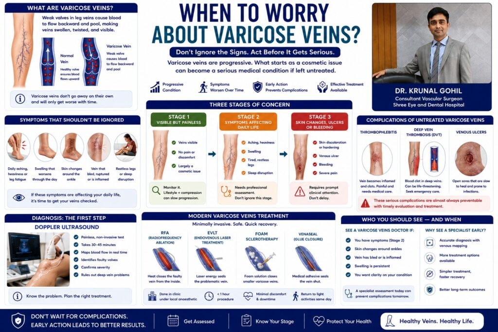 When to Worry About Varicose Veins?